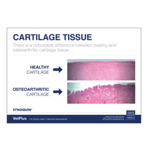 Cartilage/Lipiello Double-Sided Information Sheet